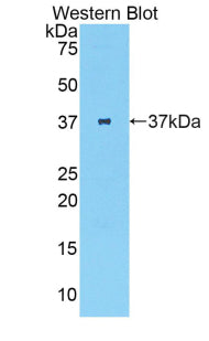Parathyroid Hormone (PTH) Polyclonal Antibody - image 2