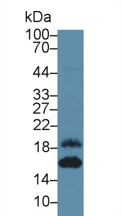 Western Blot; Sample: Recombinant ENA78, Human.