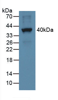 DAB staining on IHC-P; Samples: Human Liver Tissue; Primary Ab: 10µg/ml Rabbit Anti-Human ENA78 Antibody Second Ab: 2µg/mL HRP-Linked Caprine Anti-Rabbit IgG Polyclonal Antibody