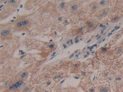 DAB staining on fromalin fixed paraffin- embedded stomach tissue)