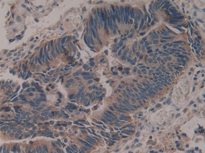 Epithelial Neutrophil Activating Peptide 78 (ENA78) Polyclonal Antibody - image 5