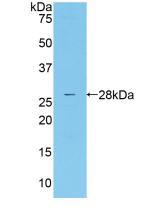DAB staining on IHC-P; Samples: Human Liver Tissue; Primary Ab: 20µg/ml Rabbit Anti-Human MASP2 Antibody Second Ab: 2µg/mL HRP-Linked Caprine Anti-Rabbit IgG Polyclonal Antibody