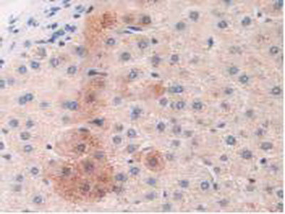 Mannose Associated Serine Protease 2 (MASP2) Polyclonal Antibody - image 5