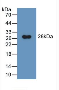 DAB staining on IHC-P; Samples: Rat Stomach Tissue; Primary Ab: 10µg/ml Rabbit Anti-Rat GluAP Antibody Second Ab: 2µg/mL HRP-Linked Caprine Anti-Rabbit IgG Polyclonal Antibody