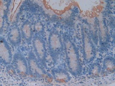 Aminopeptidase A (ENPEP) Polyclonal Antibody - image 5