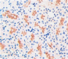 Aminopeptidase A (ENPEP) Polyclonal Antibody - image 3