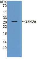 Aminopeptidase A (ENPEP) Polyclonal Antibody - image 2