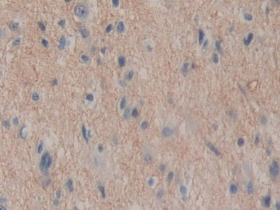 DAB staining on IHC-P; Samples: Human Liver Tissue