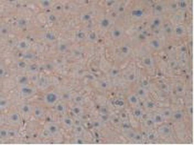 Aminopeptidase A (ENPEP) Polyclonal Antibody - image 4