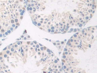 DAB staining on IHC-P; Samples: Mouse Heart Tissue