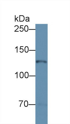Western Blot; Sample: Recombinant protein.