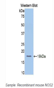 Nitric Oxide Synthase 2, Inducible (NOS2) Polyclonal Antibody - image 3