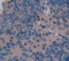 Nitric Oxide Synthase 2, Inducible (NOS2) Polyclonal Antibody - image 4