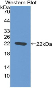 Nitric Oxide Synthase 2, Inducible (NOS2) Polyclonal Antibody - image 2