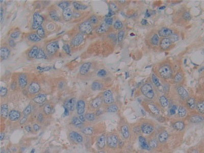 Nitric Oxide Synthase 2, Inducible (NOS2) Polyclonal Antibody - image 4