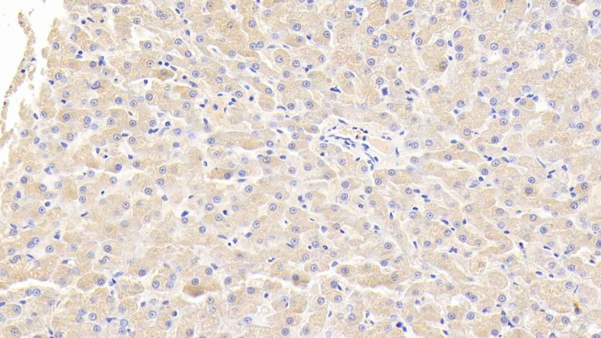 Von Willebrand Factor (vWF) Polyclonal Antibody - image 3