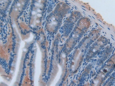 DAB staining on fromalin fixed paraffin- embedded kidney tissue)