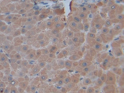 DAB staining on IHC-P; Samples:Human Stomach Tissue