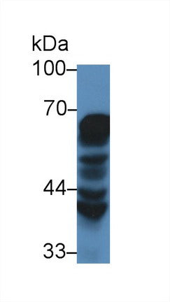 Western Blot; Sample: Recombinant protein.