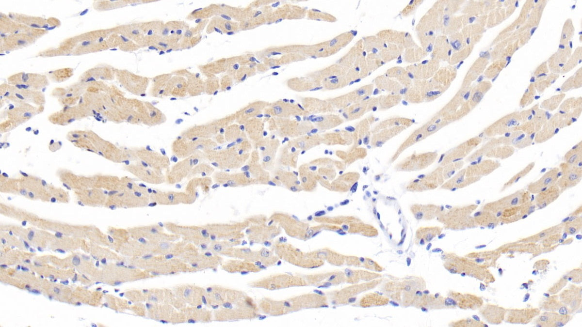 DAB staining on fromalin fixed paraffin-embedded Kidney tissue)