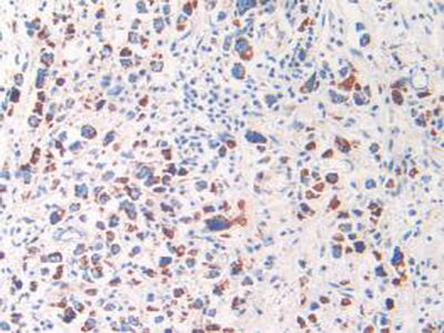 Heat Shock Protein 60 (Hsp60) Polyclonal Antibody - image 5