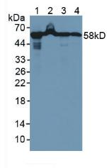 Knockout Varification: ; Lane 1: Wild-type A549 cell lysate; ; Lane 2: HSPD1 knockout A549 cell lysate; ; Predicted MW: 17,61kd ; Observed MW: 58kd; Primary Ab: 1µg/ml Rabbit Anti-Human HSPD1 Antibody; Second Ab: 0.2µg/mL HRP-Linked Caprine Anti-Rabbit IgG Polyclonal Antibody;