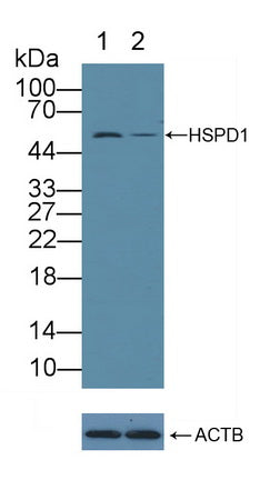 DAB staining on IHC-P; Samples: Human Small intestine Tissue; Primary Ab: 20μg/ml Rabbit Anti-Human HSPD1 Antibody Second Ab: 2µg/mL HRP-Linked Caprine Anti-Rabbit IgG Polyclonal Antibody