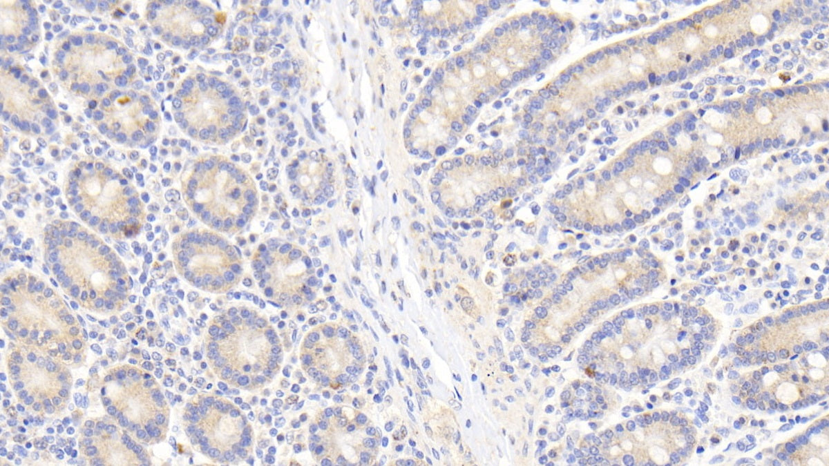DAB staining on IHC-P; Samples: Human Kidney Tissue; Primary Ab: 20μg/ml Rabbit Anti-Human HSPD1 Antibody Second Ab: 2µg/mL HRP-Linked Caprine Anti-Rabbit IgG Polyclonal Antibody