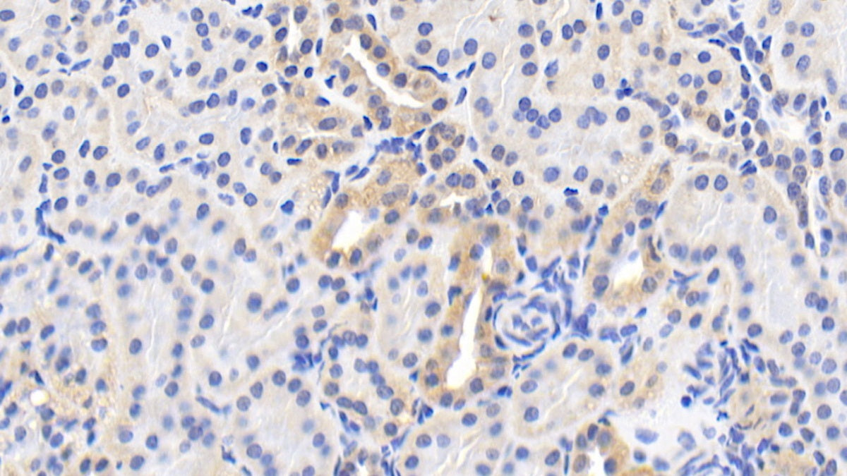 Heat Shock Protein 60 (Hsp60) Polyclonal Antibody - image 5