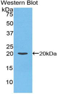 DAB staining on IHC-P; Samples: Rat Liver Tissue; Primary Ab: 20μg/ml Rabbit Anti-Rat F2 Antibody Second Ab: 2µg/mL HRP-Linked Caprine Anti-Rabbit IgG Polyclonal Antibody