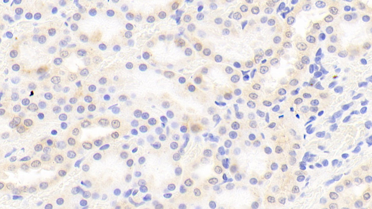 Coagulation Factor II (F2) Polyclonal Antibody - image 5