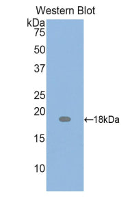 Parathyroid Hormone Related Protein (PTHrP) Polyclonal Antibody - image 2