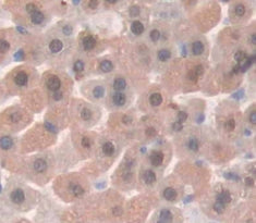 Parathyroid Hormone Related Protein (PTHrP) Polyclonal Antibody - image 3