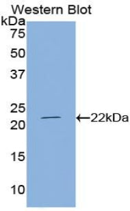 Parathyroid Hormone Related Protein (PTHrP) Polyclonal Antibody - image 2
