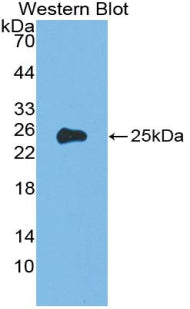 Alpha-1-Acid Glycoprotein (a1AGP) Polyclonal Antibody - image 3