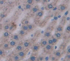 Alpha-1-Acid Glycoprotein (a1AGP) Polyclonal Antibody - image 4