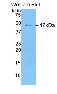 Alpha-1-Acid Glycoprotein (a1AGP) Polyclonal Antibody - image 2