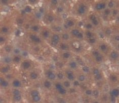 Alpha-1-Acid Glycoprotein (a1AGP) Polyclonal Antibody - image 3