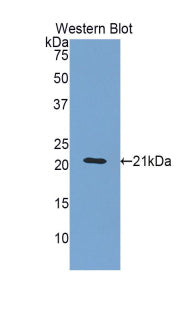 Alpha-1-Acid Glycoprotein (a1AGP) Polyclonal Antibody - image 2