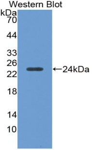 DAB staining on IHC-P; Samples: Porcine Liver Tissue;  Primary Ab: 20µg/ml Rabbit Anti-Porcine a1AGP