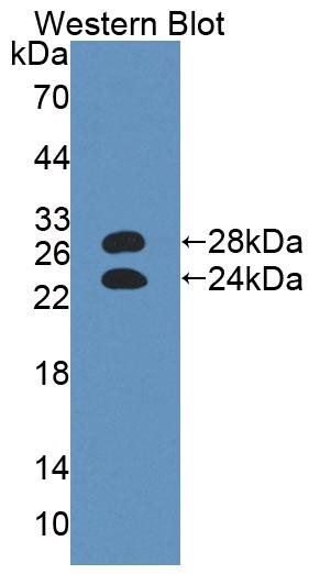 DAB staining on IHC-P; Samples: Mouse Liver Tissue;  Primary Ab: 10µg/ml Rabbit Anti-Mouse a1AGP Ant