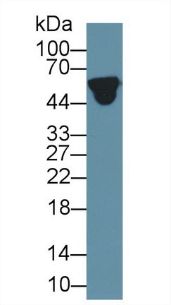 Western Blot; Sample: Human Lung lysate; ; Primary Ab: 1µg/ml Rabbit Anti-Human a1AGP Antibody; Second Ab: 0.2µg/mL HRP-Linked Caprine Anti-Rabbit IgG Polyclonal Antibody;