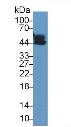 Used in DAB staining on fromalin fixed paraffin-embedded Liver tissue