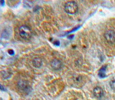 Alpha-1-Acid Glycoprotein (a1AGP) Polyclonal Antibody - image 4
