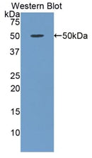 Western Blot; Sample: Bovine Serum; Primary Ab: 2µg/mL Rabbit Anti-Bovine a1AGP Antibody; Second Ab: 0.2µg/mL HRP-Linked Caprine Anti-Rabbit IgG Polyclonal Antibody;
