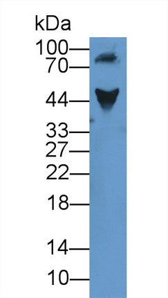 Alpha-1-Acid Glycoprotein (a1AGP) Polyclonal Antibody - image 3