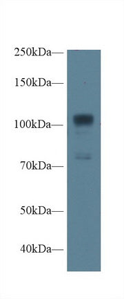 Western Blot; Sample: Recombinant protein.