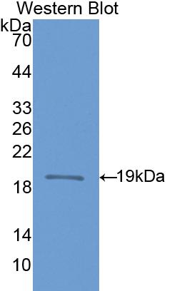 DAB staining on IHC-P; Samples: Rat Cerebrum Tissue; Primary Ab: 10μg/ml Rabbit Anti-Rat NOS1 Antibody Second Ab: 2µg/mL HRP-Linked Caprine Anti-Rabbit IgG Polyclonal Antibody