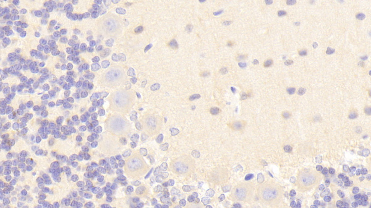 Nitric Oxide Synthase 1, Neuronal (NOS1) Polyclonal Antibody - image 5