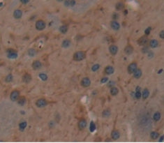 Nitric Oxide Synthase 1, Neuronal (NOS1) Polyclonal Antibody - image 4